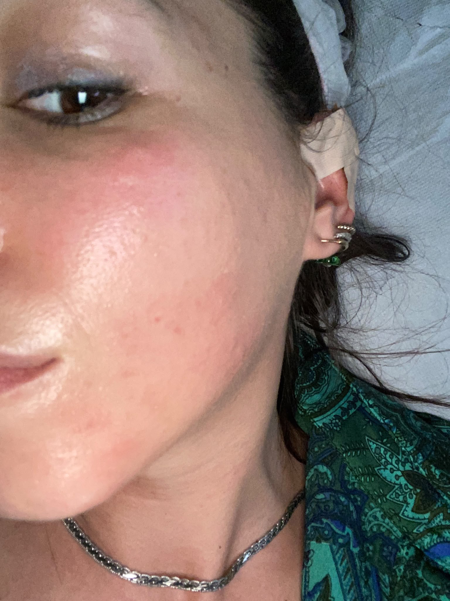 Dettaglio professionale di trattamento viso Mood per luminosità e qualità della pelle